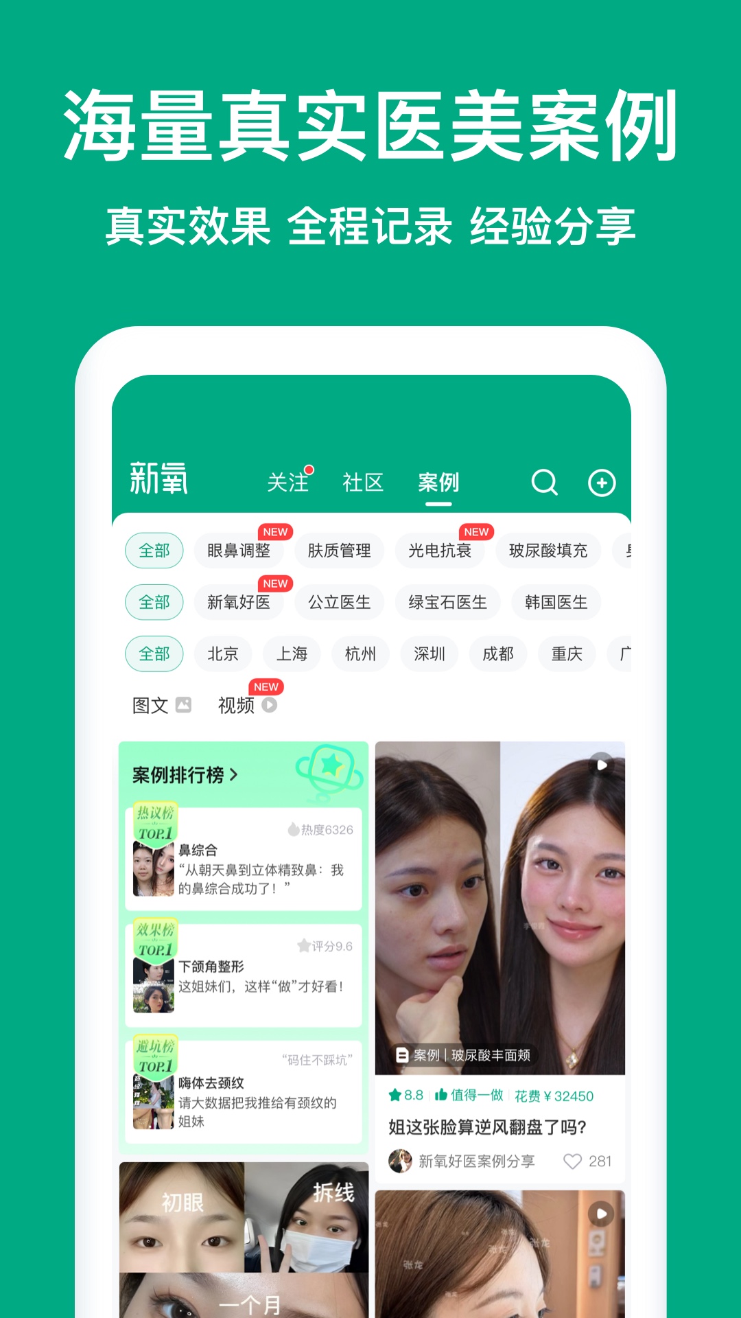 新氧极速版展示图3