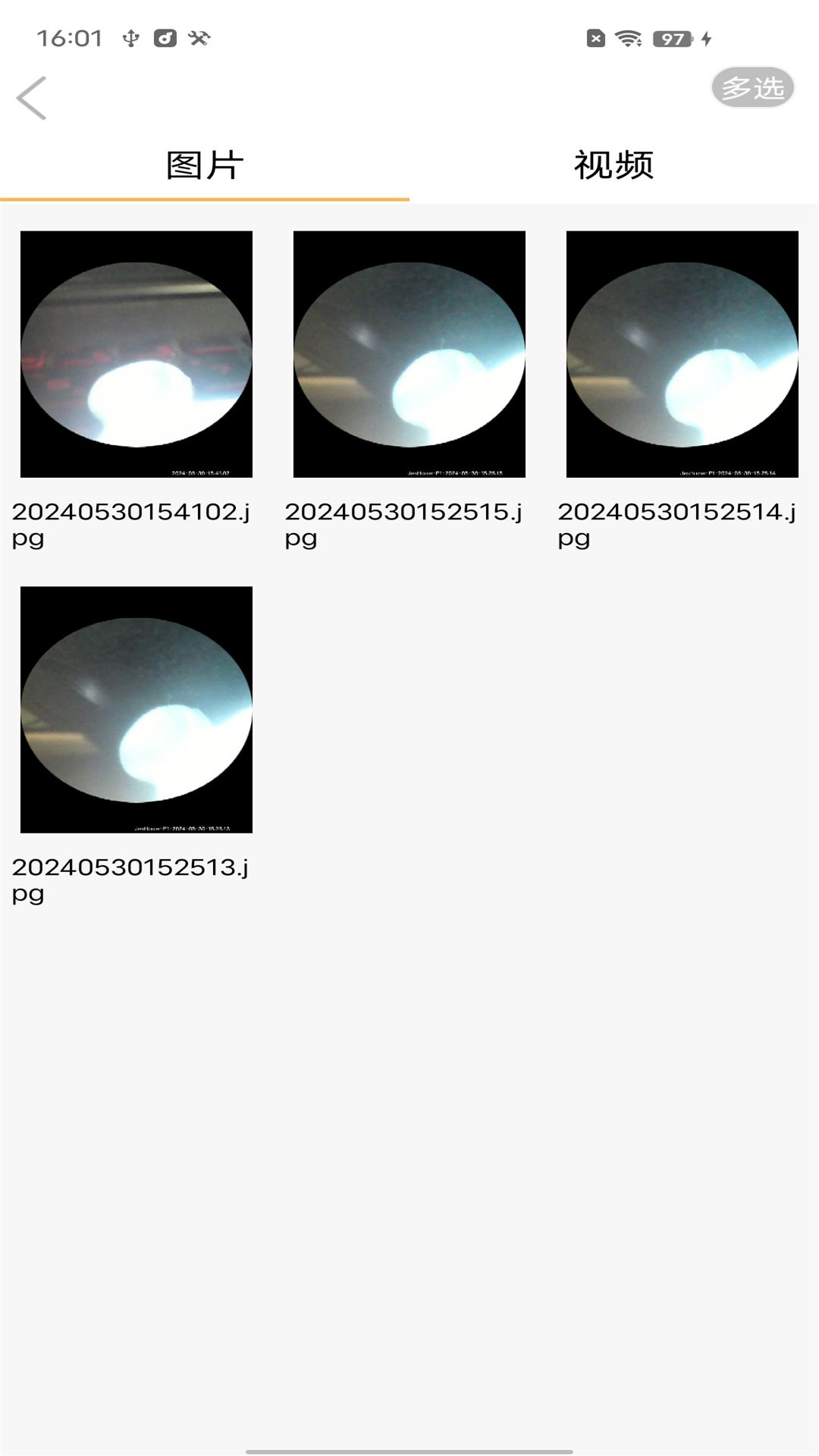 可视耳勺app展示图4