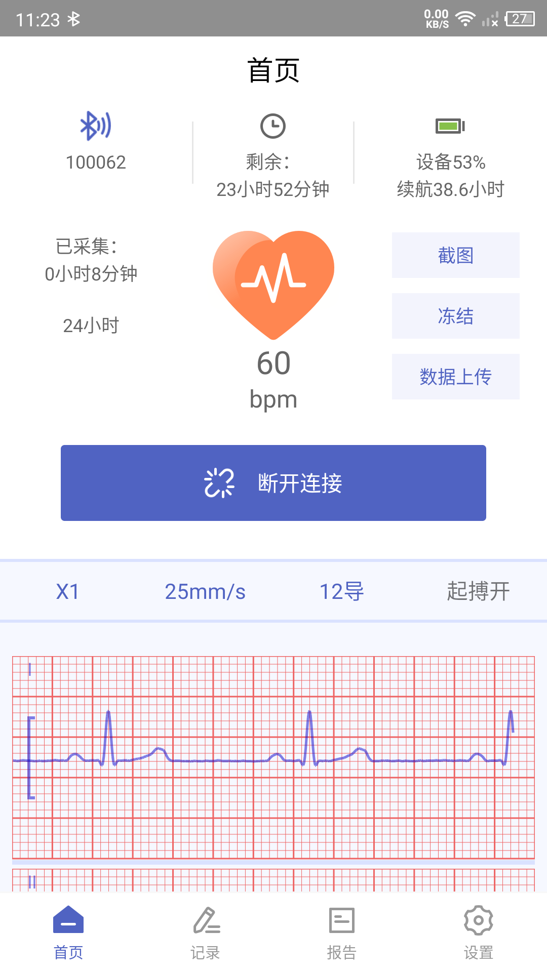 联影小智健康展示图1