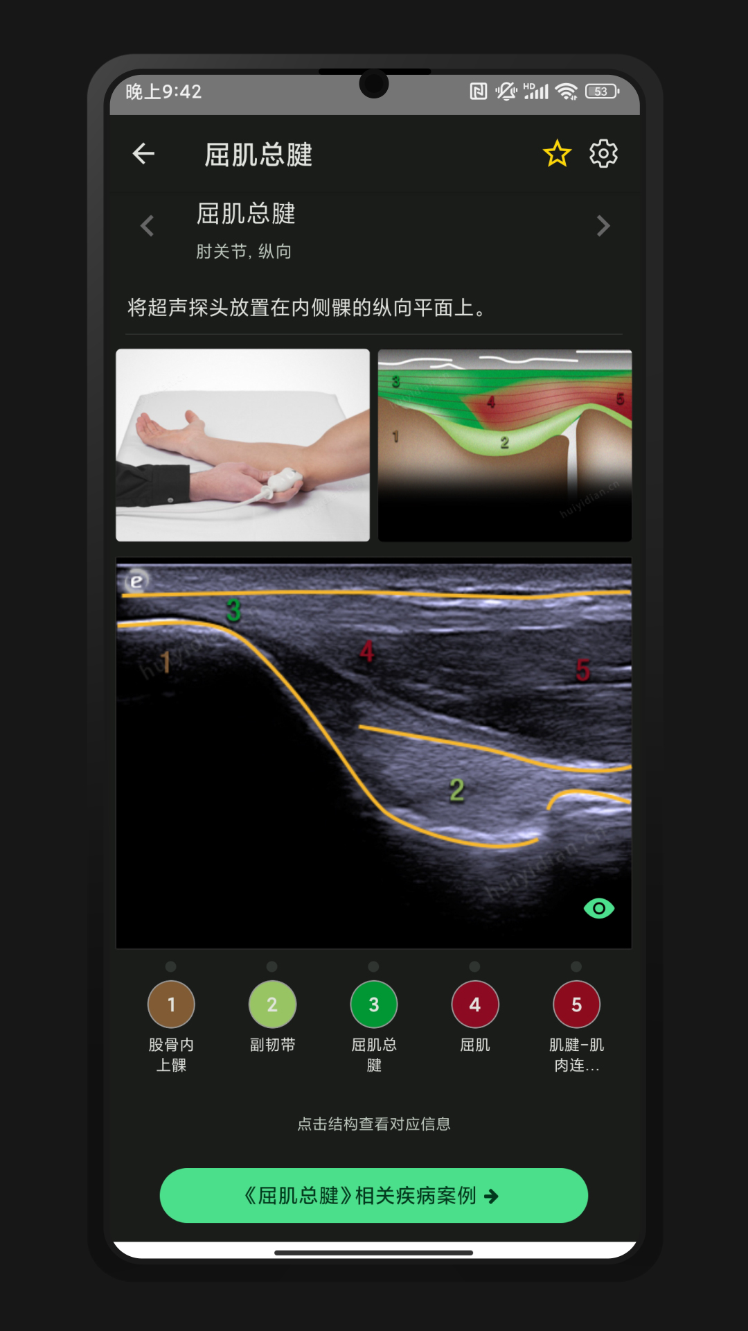 超声智学展示图2