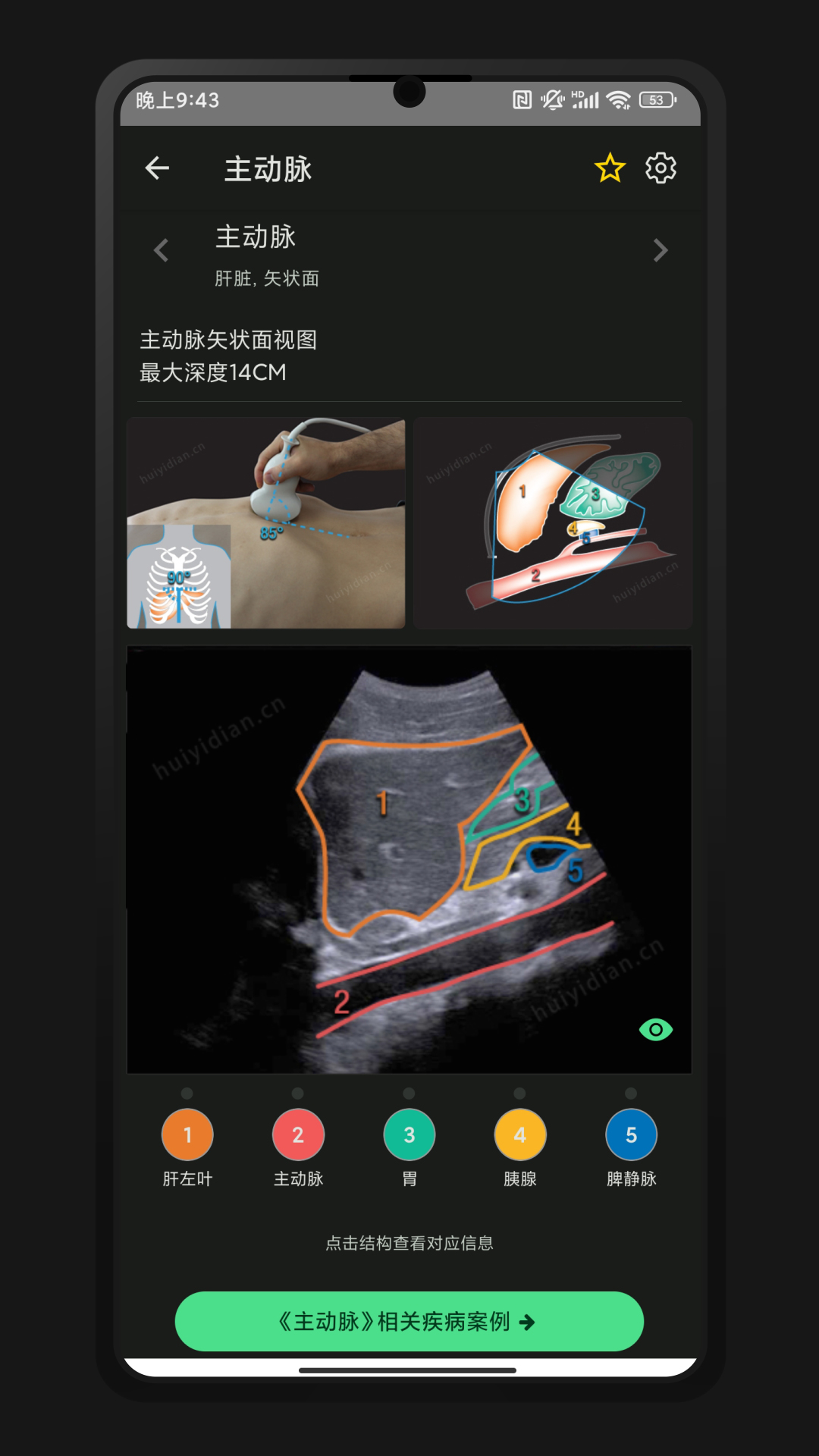 超声智学展示图1
