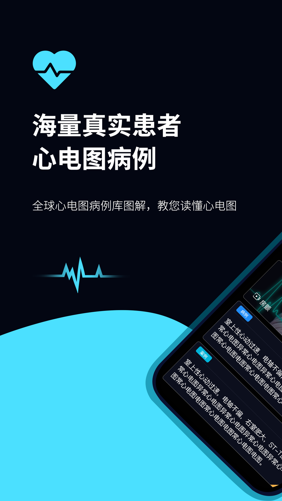 心电图ECG app展示图1