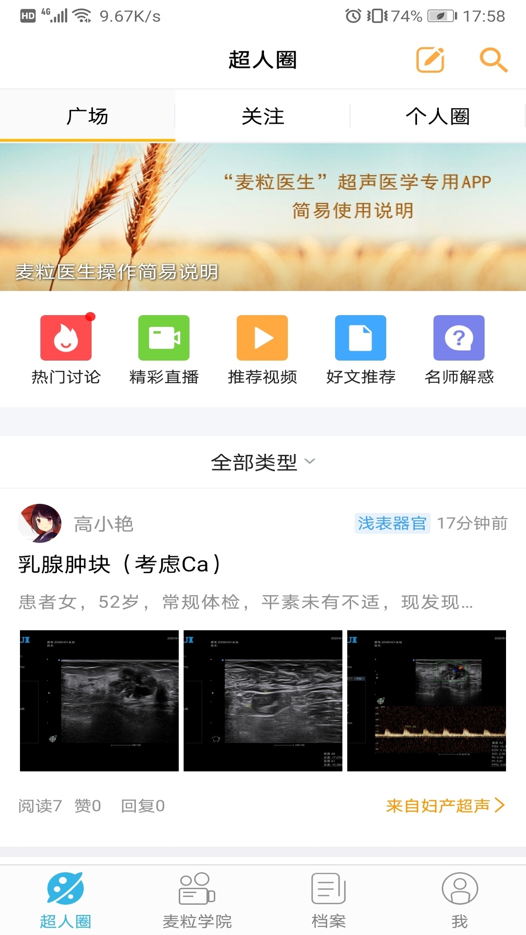 麦粒医生app展示图1