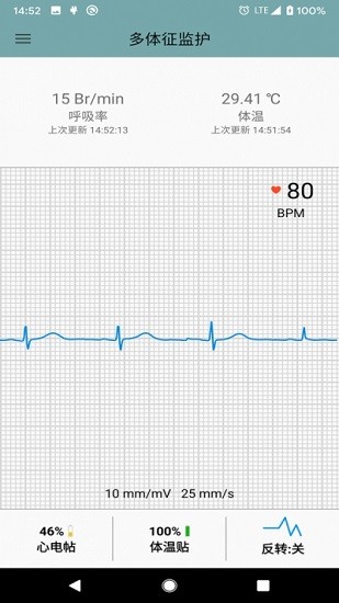 多体征监护app展示图2