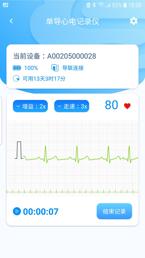 星康心电软件展示图4