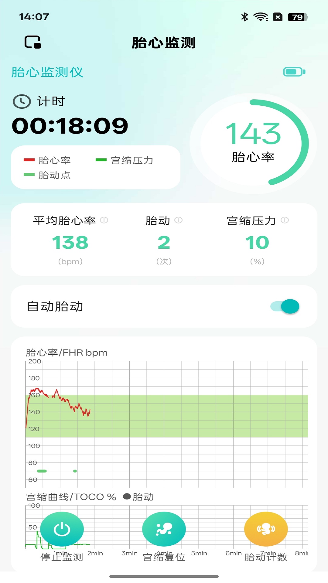 喜芽Pro软件展示图1