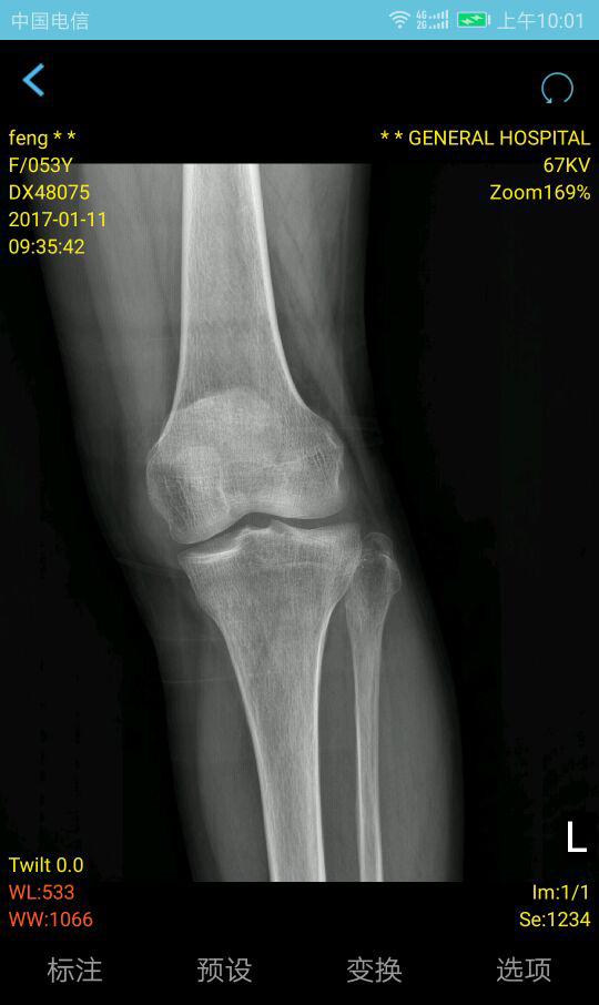 飞图影像的方式app软件展示图3